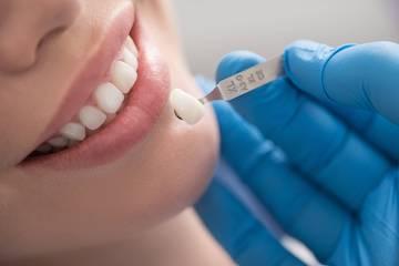 A woman getting veneers