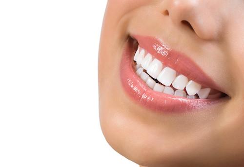 A smiling woman with white teeth