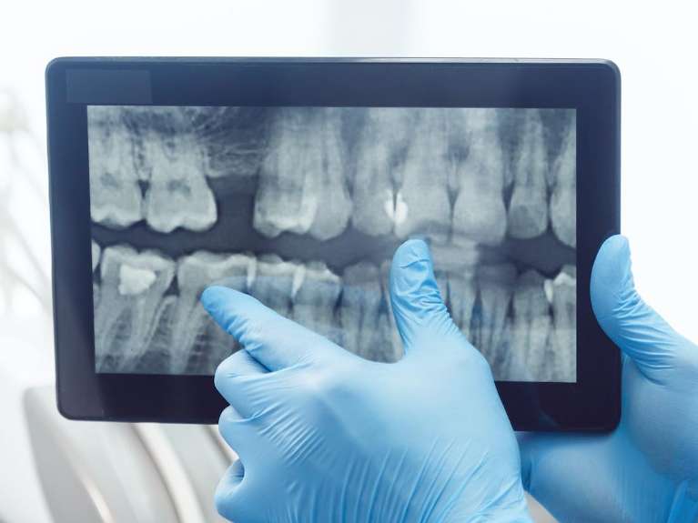 Digital x-ray | dentist Langhorne PA